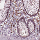 Immunohistochemical staining of human rectum shows moderate cytoplasmic positivity in lymphoid cells.