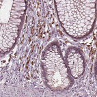 Anti-CXCL16 Antibody