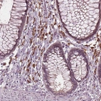 Immunohistochemical staining of human rectum shows moderate cytoplasmic positivity in lymphoid cells.
