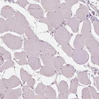 Immunohistochemical staining of human skeletal muscle shows no positivity in myocytes as expected.