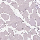 Immunohistochemical staining of human skeletal muscle shows no positivity in myocytes as expected.
