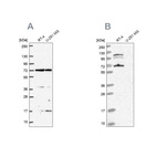 Western blot analysis using Anti-ARAF antibody HPA066326 (A) shows similar pattern to independent antibody HPA046188 (B).