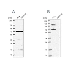Western blot analysis using Anti-ARAF antibody HPA066326 (A) shows similar pattern to independent antibody HPA046188 (B).