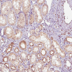 Anti-EMD Antibody