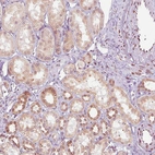 Immunohistochemical staining of human kidney shows moderate nuclear membrane positivity in a subset of cells in tubules.