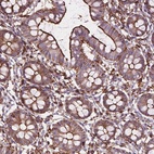 Anti-PATJ Antibody