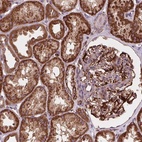 Anti-GOLT1B Antibody