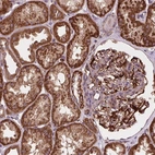 Anti-GOLT1B Antibody