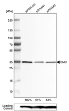 Western blot analysis in RT-4 cells transfected with control siRNA, target specific siRNA probe #1 and #2, using Anti-EMD antibody. Remaining relative intensity is presented. Loading control: Anti-PPIB.