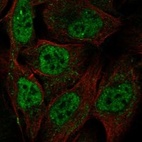 Anti-MCM8 Antibody