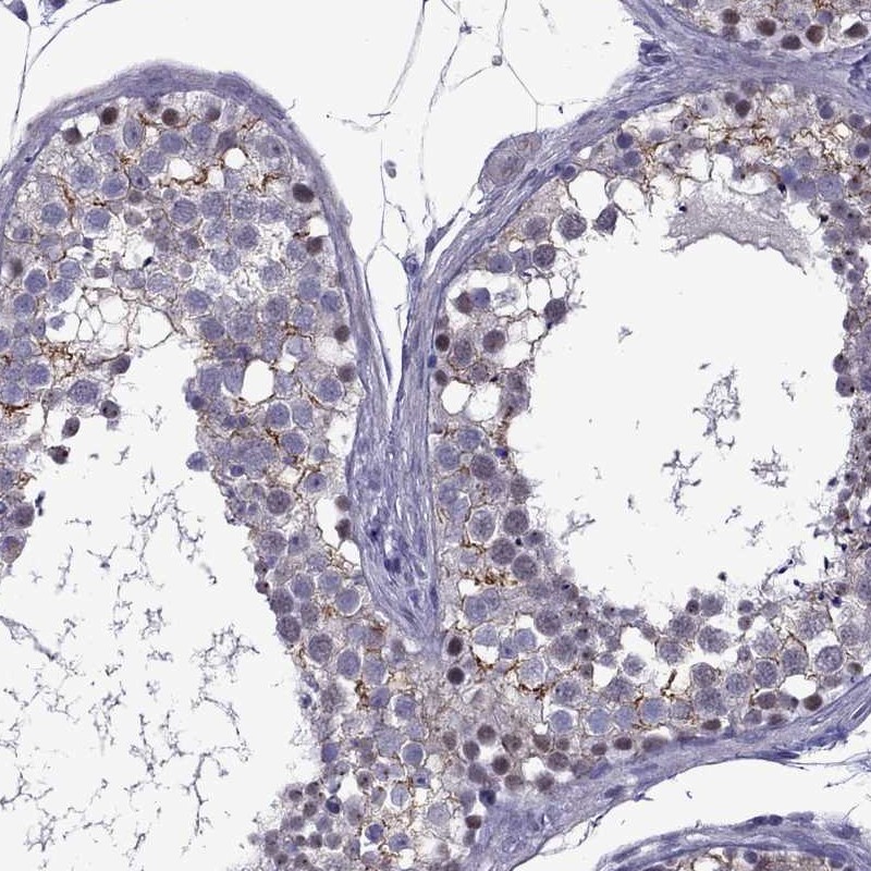 Anti-ZNF646 Antibody