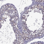 Anti-ZNF646 Antibody