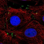 Immunofluorescent staining of human cell line MCF7 shows localization to focal adhesion sites.