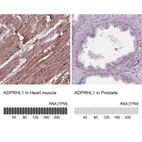 Anti-ADPRHL1 Antibody