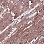 Immunohistochemical staining of human heart muscle shows high expression.