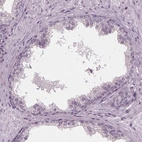 Immunohistochemical staining of human prostate shows low expression as expected.
