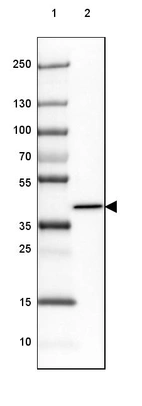 Lane 1: Marker [kDa] 250, 130, 100, 70, 55, 35, 25, 15, 10_br/_Lane 2: Human Skeletal muscle tissue