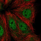 Immunofluorescent staining of human cell line MCF7 shows localization to nucleoplasm.