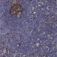 Anti-ARHGAP11A Antibody