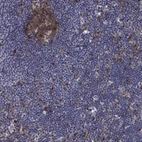 Anti-ARHGAP11A Antibody