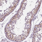 Anti-GP6 Antibody