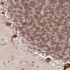 Immunohistochemical staining of human cerebellum shows strong cytoplasmic positivity in Purkinje cells.