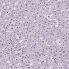 Immunohistochemical staining of human liver shows no positivity in hepatocytes as expected.
