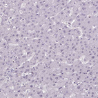 Anti-GP6 Antibody