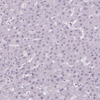 Immunohistochemical staining of human liver shows no positivity in hepatocytes as expected.