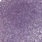 Immunohistochemical staining of human tonsil shows no positivity in germinal center cells as expected.