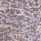 Immunohistochemical staining of human adrenal gland shows strong positivity in cytoplasm granular in glandular cells.