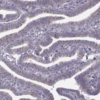 Immunohistochemical staining of human fallopian tube shows moderate positivity in cytoplasm granular in glandular cells.