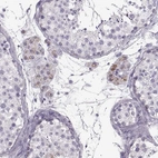 Immunohistochemical staining of human testis shows weak positivity in cytoplasm granular in Leydig cells.