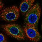 Immunofluorescence staining in MCF7 cell line with Anti-EMD monoclonal antibody, shows a distinct nuclear membranous pattern with a weaker additional ER staining in green. Microtubule- and nuclear probes are visualized in red and blue respectively (where available).