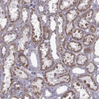 Immunohistochemical staining of human kidney shows moderate positivity in cytoplasm granular in cells in tubules.