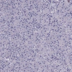 Immunohistochemical staining of human pancreas shows negative positivity in cytoplasm granular in exocrine glandular cells as expected.
