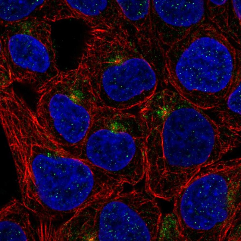 Anti-TMEM63A Antibody