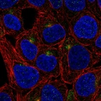 Anti-TMEM63A Antibody