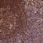 Anti-RNASET2 Antibody