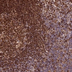 Anti-RNASET2 Antibody