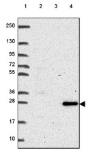 Anti-RNASET2 Antibody