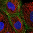 Immunofluorescent staining of human cell line A-431 shows localization to plasma membrane & actin filaments.