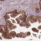 Immunohistochemical staining of human prostate shows moderate cytoplasmic positivity in glandular cells.