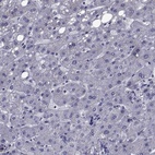 Anti-SEMA5B Antibody