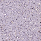 Immunohistochemical staining of human liver shows no positivity in hepatocytes as expected.
