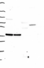 Lane 1: Marker [kDa] 250, 130, 95, 72, 55, 36, 28, 17, 10 | Lane 2: RT4 | Lane 3: U-251 MG | Lane 4: Human Plasma | Lane 5: Liver | Lane 6: Tonsil