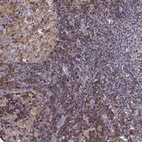Immunohistochemical staining of human lymph node shows high expression.