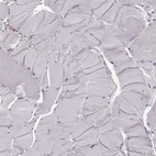 Immunohistochemical staining of human skeletal muscle shows low expression as expected.
