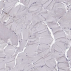 Immunohistochemical staining of human skeletal muscle shows low expression as expected.