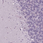 Anti-SMIM18 Antibody